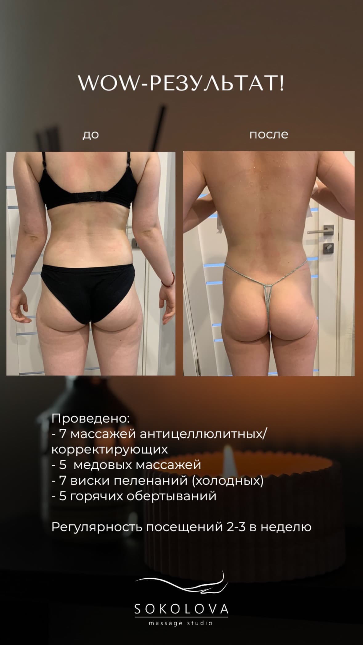 Результат антицеллюлитного массажа